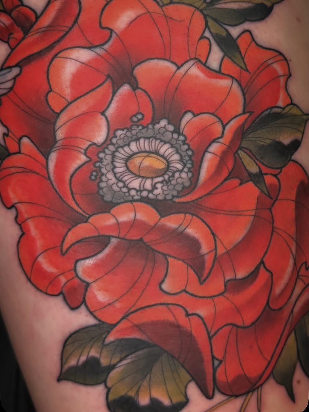 sarastigmata