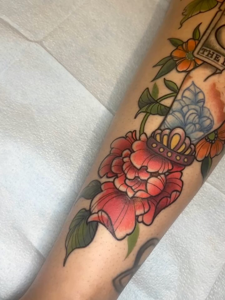 sarastigmata