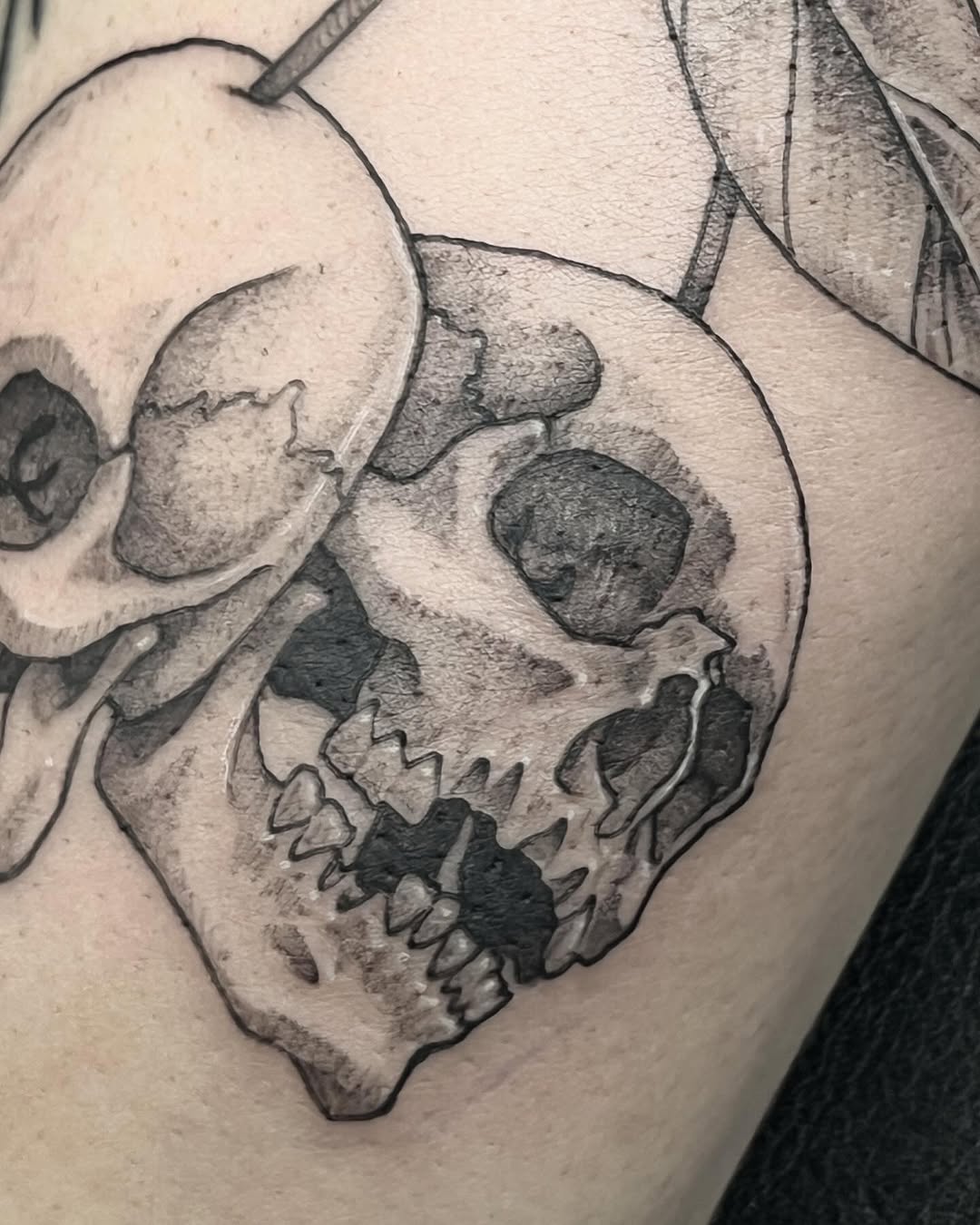 urchinbite
