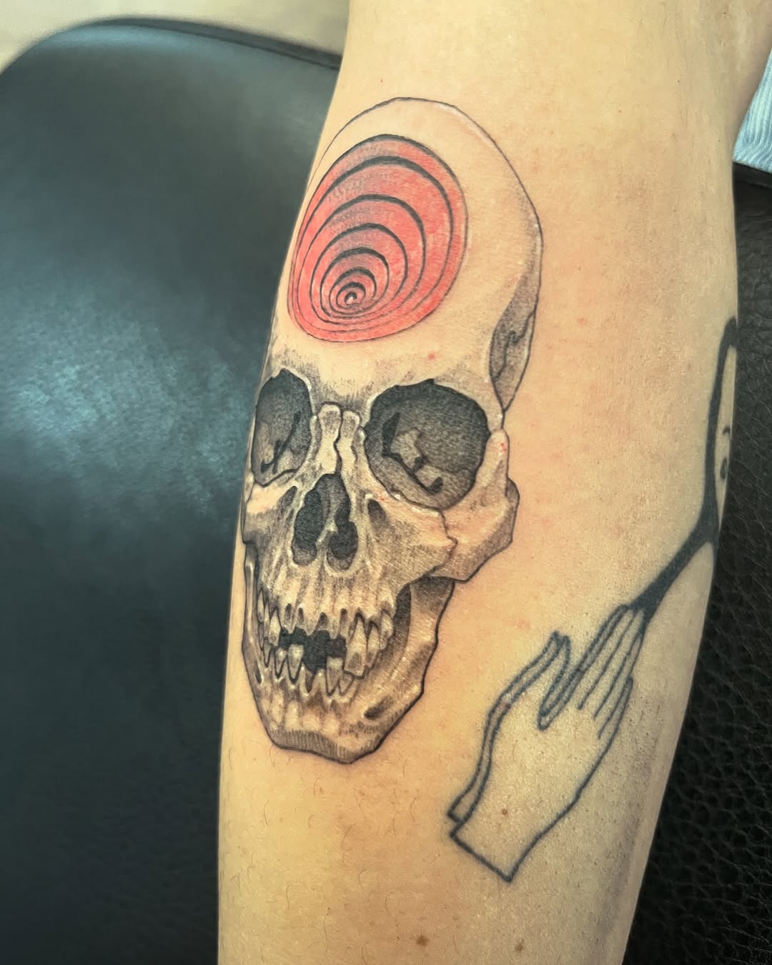 urchinbite