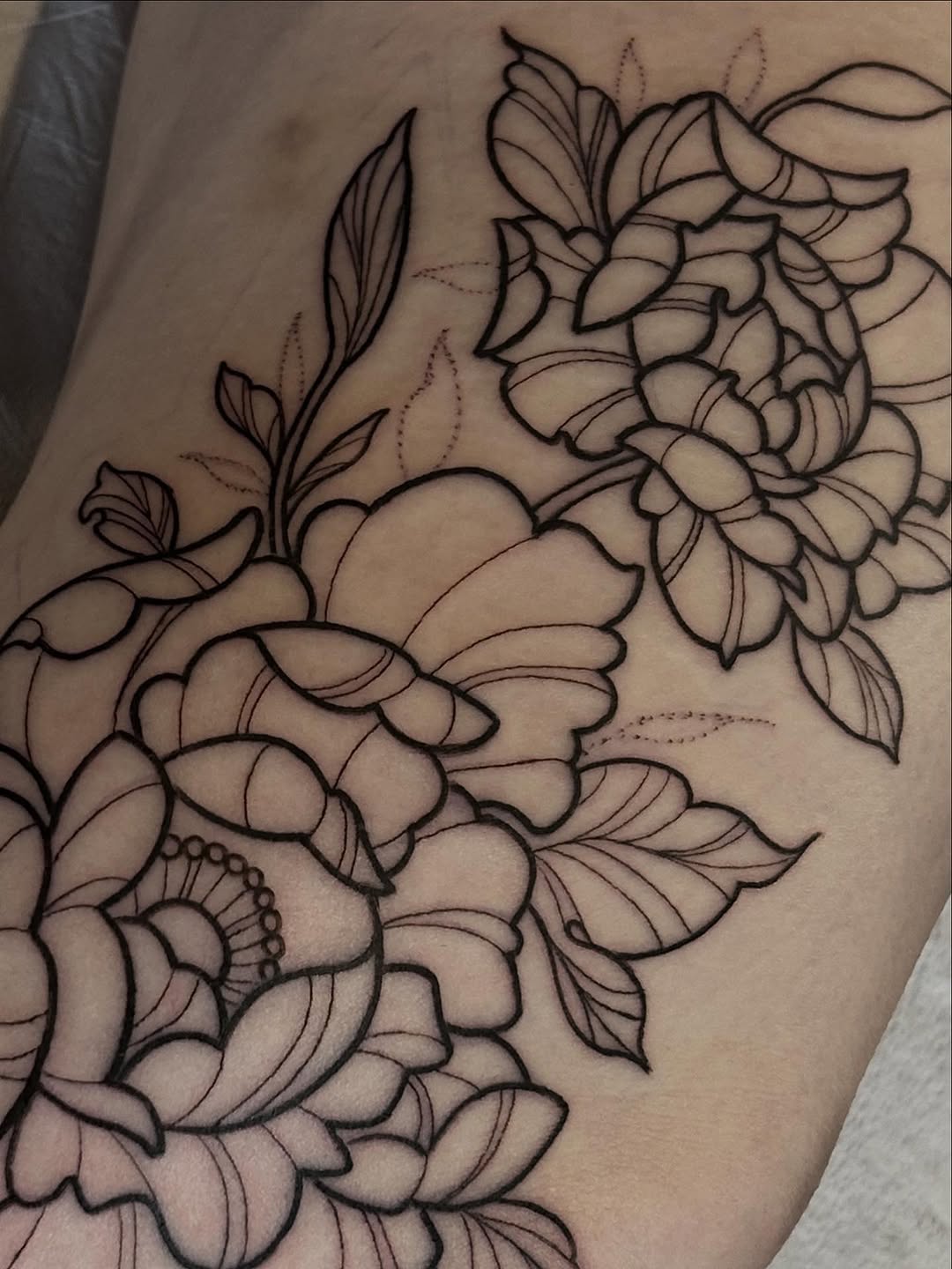 sarastigmata