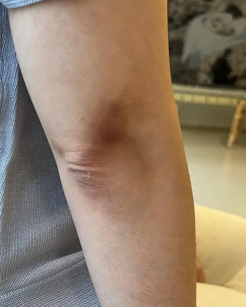 narrtats