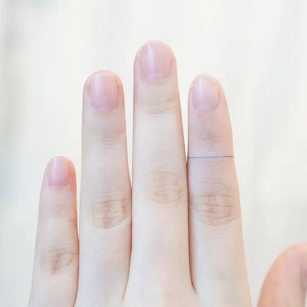 리본, 아이리스