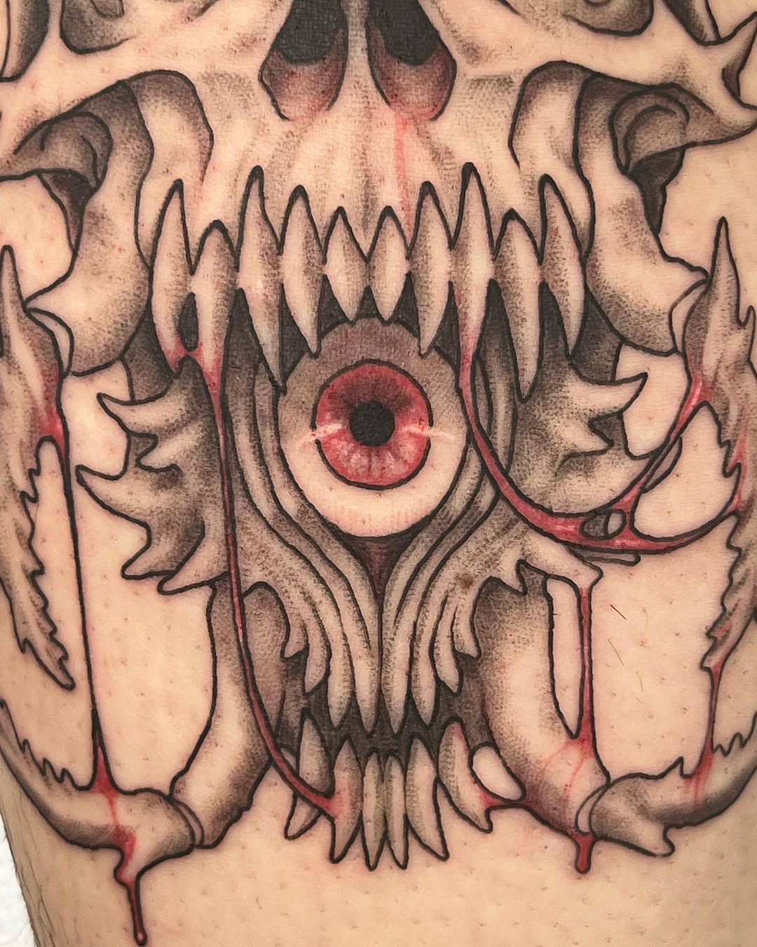 urchinbite