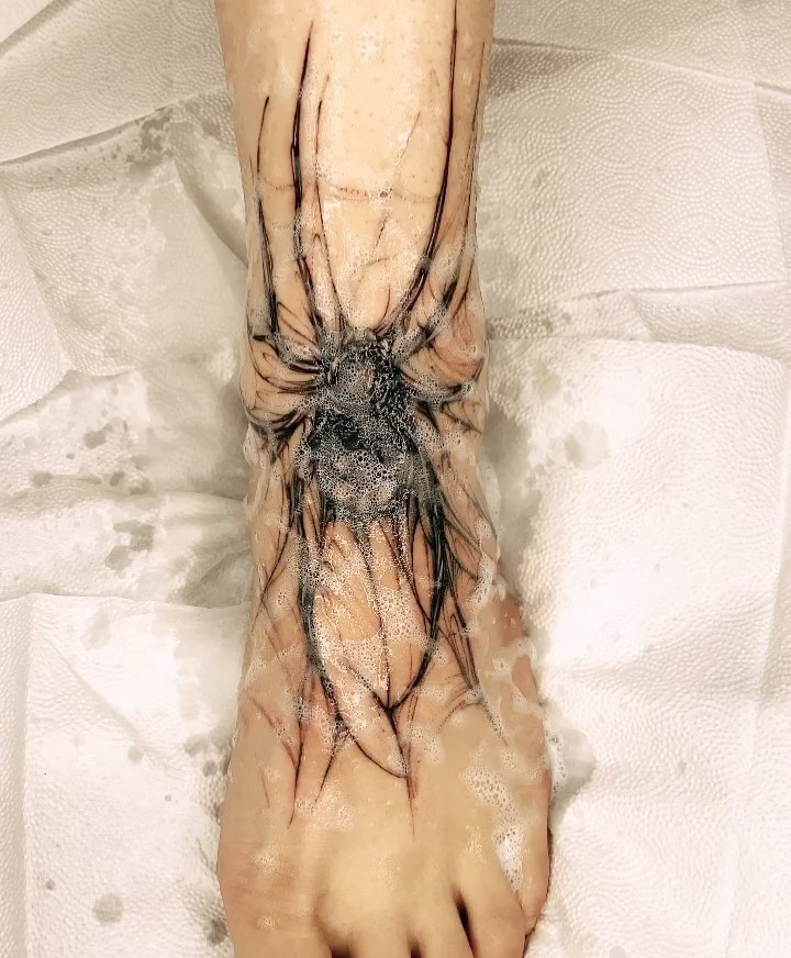 Animal