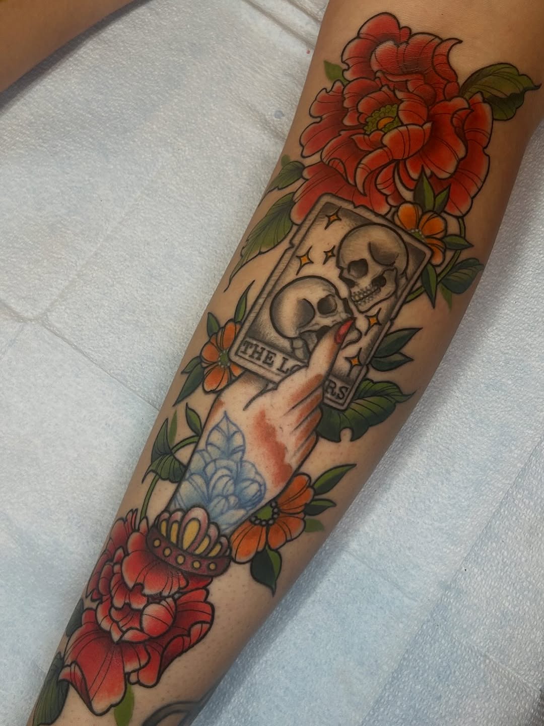 sarastigmata