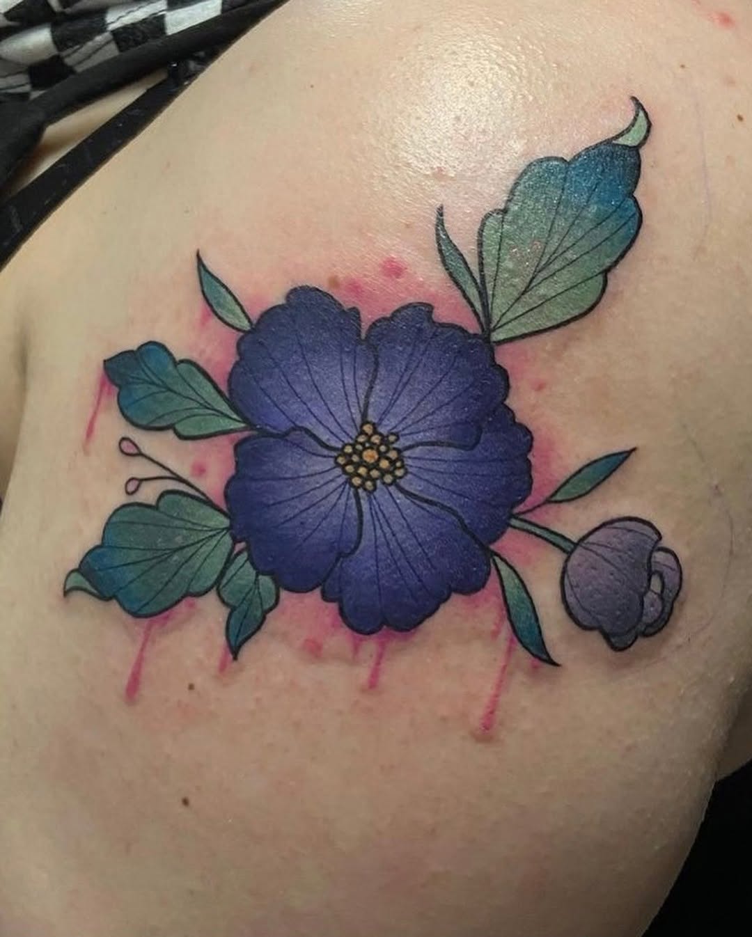 sarastigmata