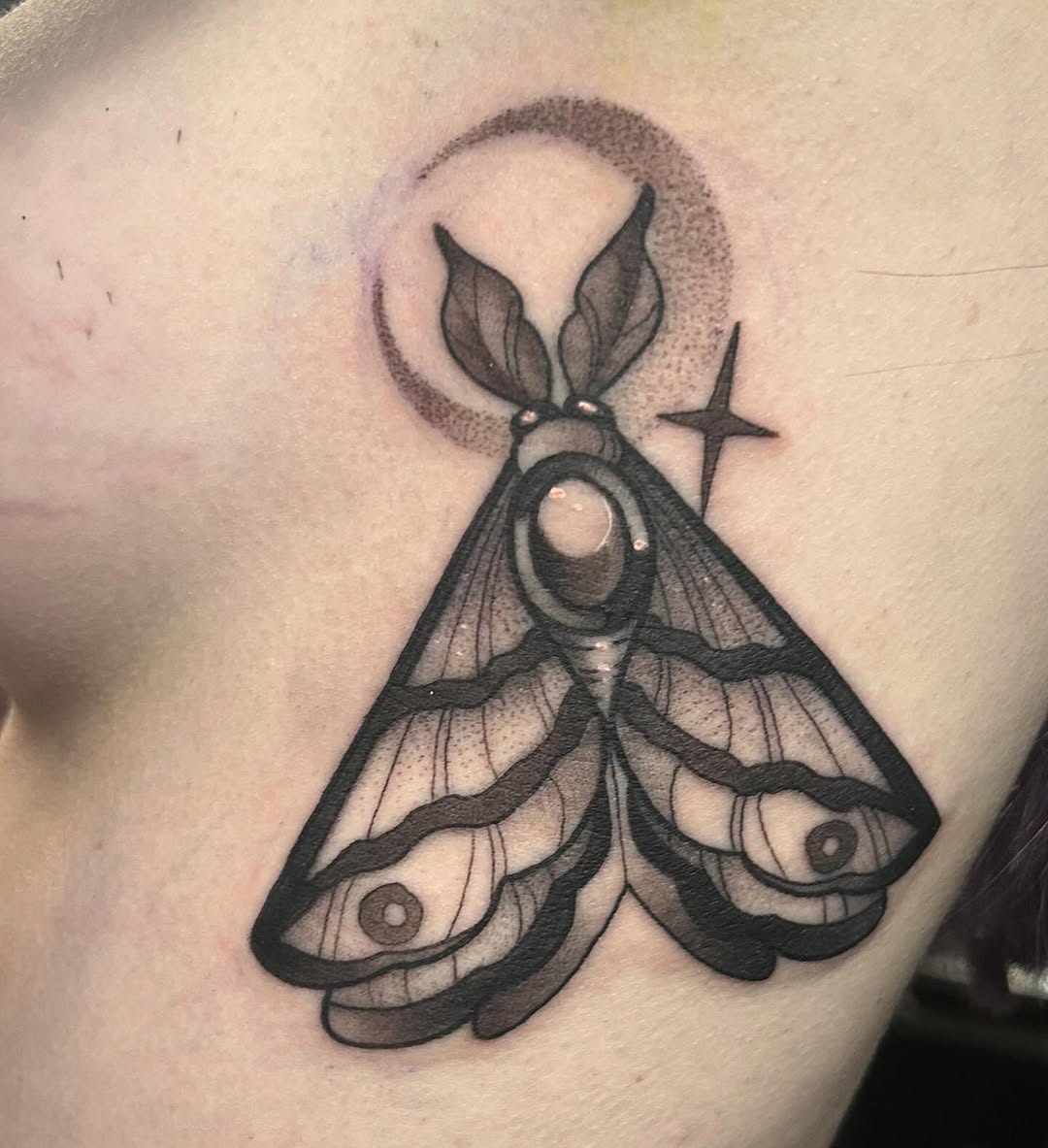 sarastigmata