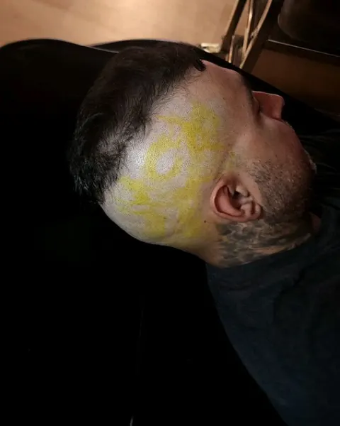 toxycxlr
