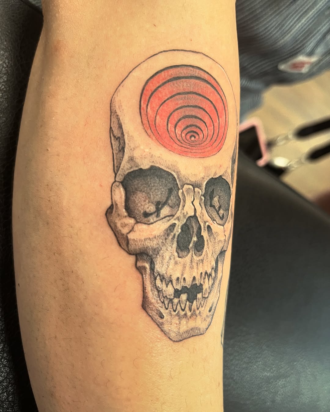urchinbite