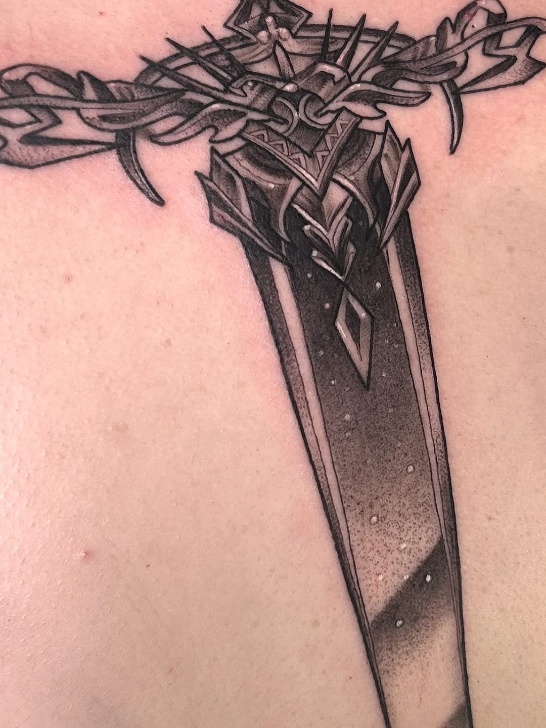 sarastigmata