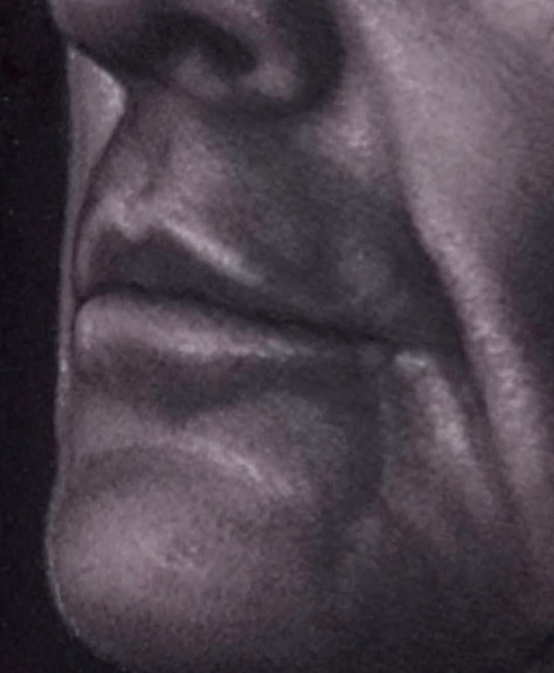 ralfnonnweilerta2