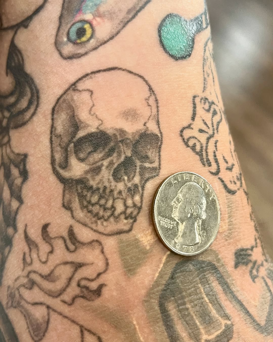urchinbite