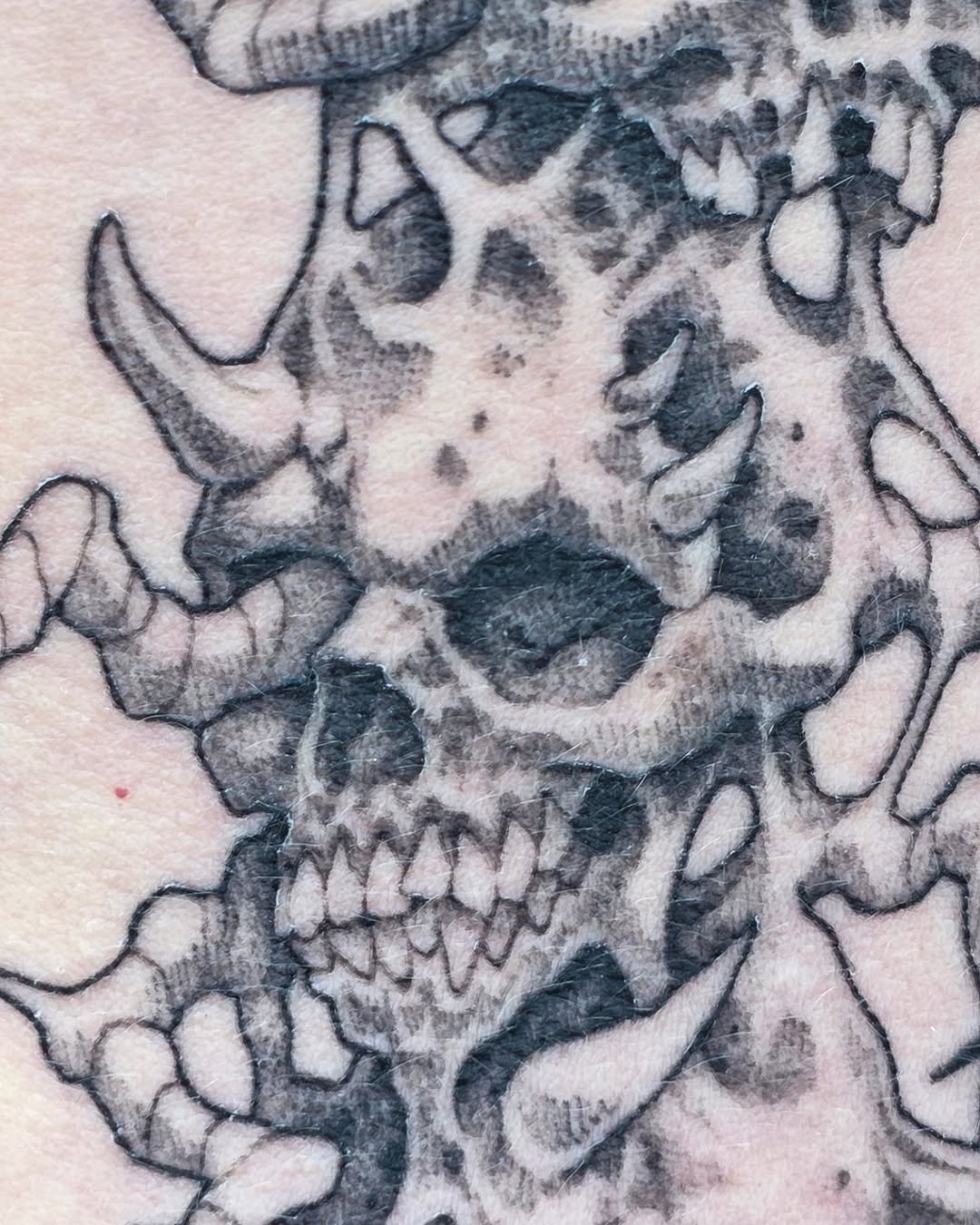 urchinbite