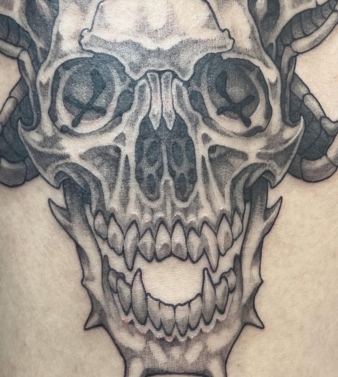 urchinbite