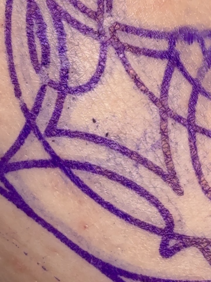 unpulso