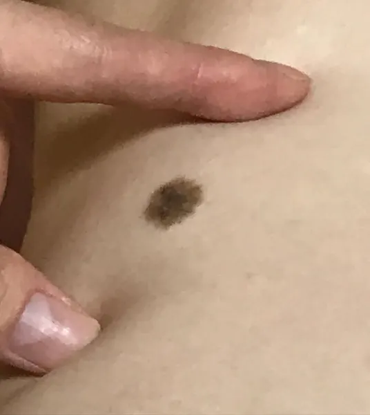 데이지, 해바라기, 민들레