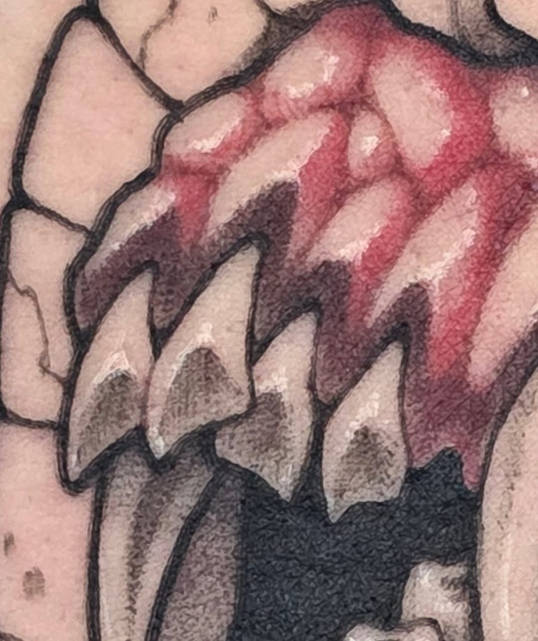 urchinbite