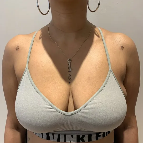 loko_lines