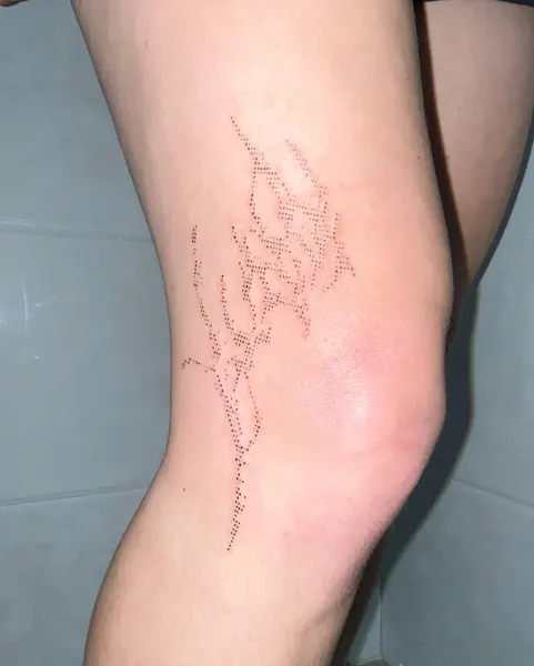 체인, 치유, 가시철사