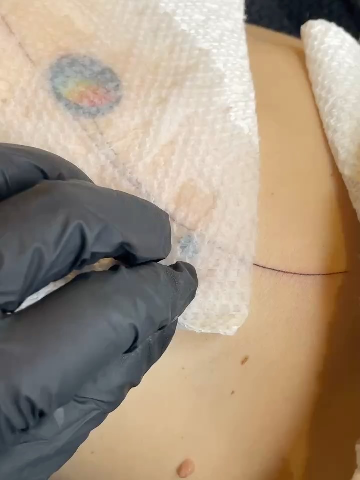 blekanddots