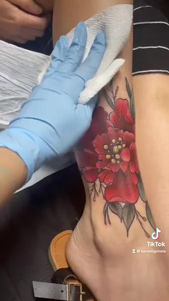 sarastigmata