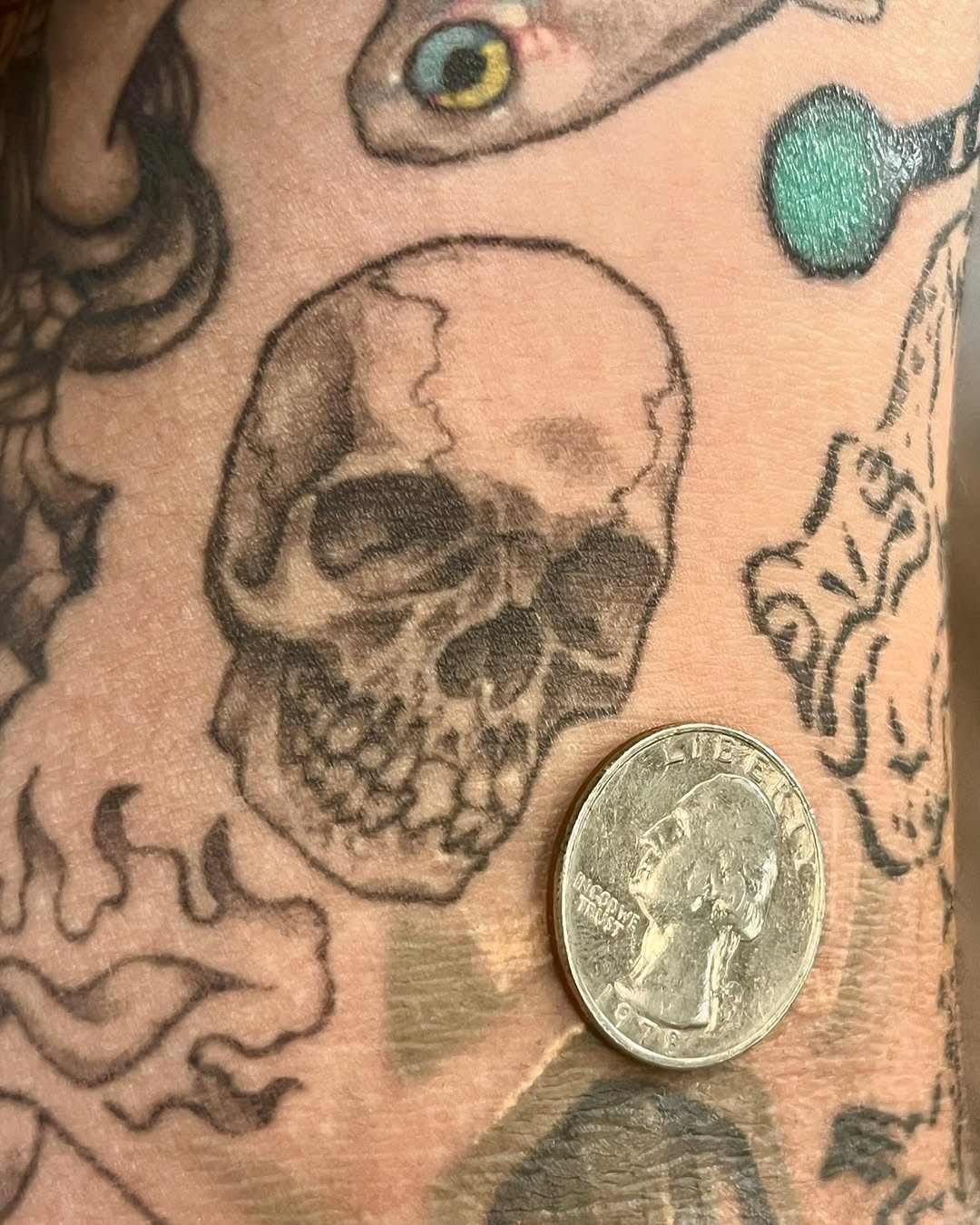 urchinbite
