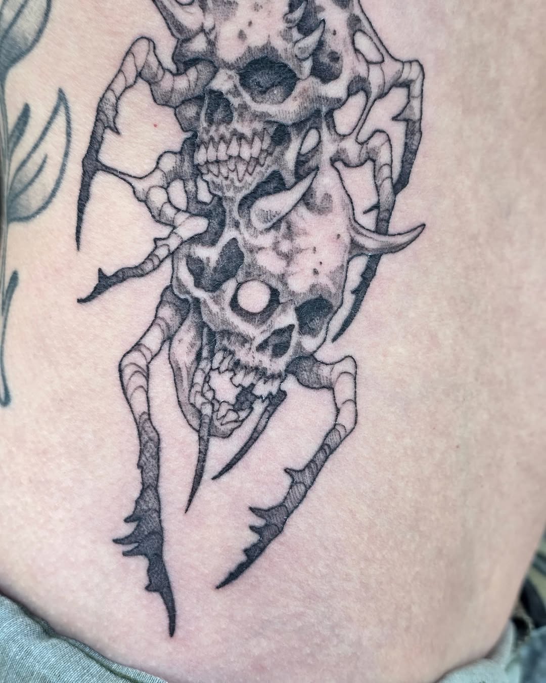 urchinbite